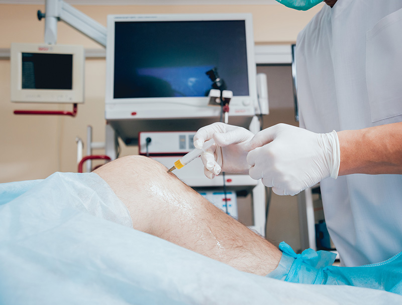 PRP for Injuries