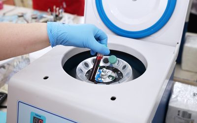 The Process of Making Platelet-Rich Plasma (PRP)